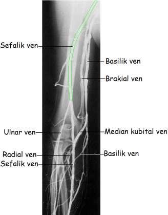 3.1.3. Göğüs Venleri Resim 3.13: Üst ekstremite kol ve ön kol venogramı Toraks duvarının ve toraks boģluğunda yer alan birçok organın venöz kanı, v.azygos ve v. hemiazygos vasıtasıyla toplanır. V.azygos: göğüs boģluğunun sağ arka bölümünde, omurganın sağında ona paralel olarak uzanan tek vendir.