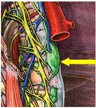 4.5. Büyük Lenf Toplardamarları (Truncus lymphaticus) Lenf damarlarının daha geniģ çaplı ve daha uzun olan bölümlerine, lenfatik trunkus denir. Vücutta 5 adet truncus lymphaticus vardır. (Resim 4.