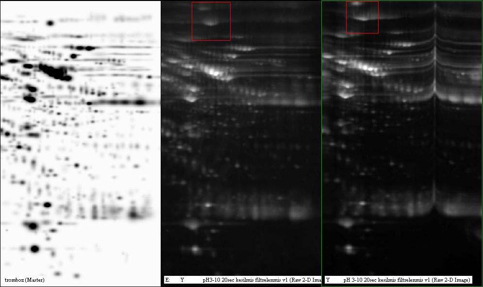 Proteomik Analiz(2D) (Plazma-pH 3-10,Sypro