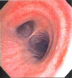 Soluk borusu (trachea)