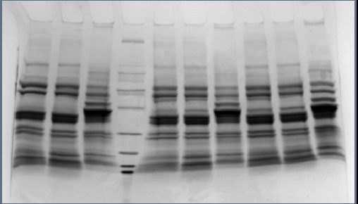 A B C D E F G H I J 200 kda 116 kda 97 kda 66,2 kda 45 kda 31 kda 21,5 kda 14,4 kda Şekil 4.9. Hindi sucuklarında üretim aşamalarında (dinlenmiş hamur, fermentasyon ve fermentasyon sonrası kurutma) belirlenen SDS-PAGE sarkoplazmik protein profilleri.