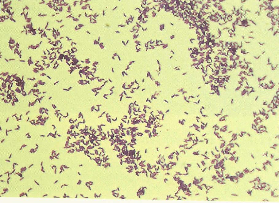 Etiyoloji Corynebacterium diphteriae Gram pozitif, aerob, kapsülsüz, sporsuz, pleomorfik basil Neisser boyası ile