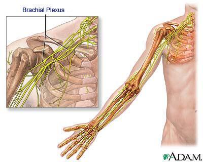 KLİNİK BAĞLANTI VE YORUM Plexus brachialis lezyonlari Plexus brachialis lezyonlari +N.thoracicus longus;meme cerrahisinde ve thorax cerrahisinde en cok yaralanan sinirdir.