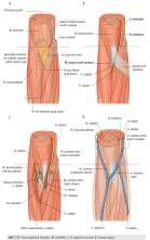 Ulna ve humerus tan başlar, tendonu 2-5. parmakların distal phalanx larına tutunur. Derin Grup Kaslar 1. M.