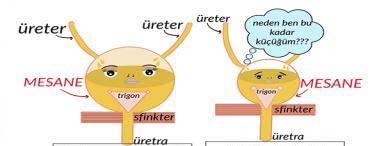 VI. Üriner Sistemin Değerlendirmesi Supravezikal üriner diversiyon Transplantasyondan 10-12 hafta