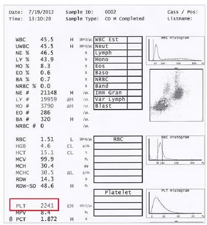 CBC Veri Analiz Sonuçları Genesis PRP performansı Operasyon zamanı Veri 5 dakika Trombositlerin ortalama geri kazanım oranı %88 Ortalama akyuvar sayısı (10³/µl) 45,5