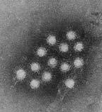 Hepatit virüsleri Virüsler, hepatitin özellikle sık görülen bir nedenidir. En önemli virüsler Hepatit A, B, C, D ve E'dir.