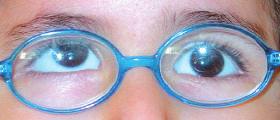 Uzak ve yak ndaki kayma aç lar aras nda fark olmayan veya bir gözünde derin ambliyopisi olan çocuklarda ayn gözde iç rektusa geriletme ve d fl rektusa rezeksiyon uygulanabilir