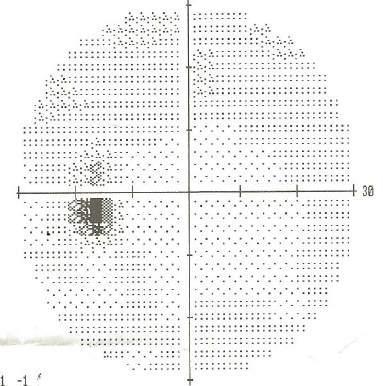 1 RG:19/21 L tam RG:20/21 GA: sağda santral