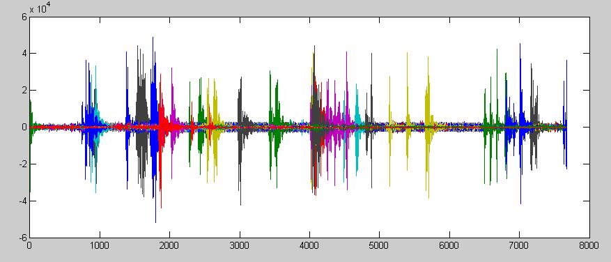 7 ġekil 1.5. EMG sinyal örneği 1.2.3.3. EOG (Electroculogram) Göz yuvarı, göz çukurundaki kasların etkisiyle hareket eder.