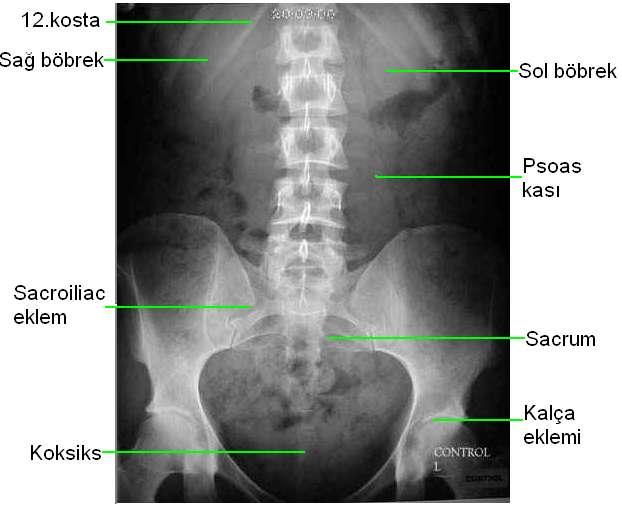 2.4.Üriner Sistem Radyografilerinde Anatomik Yapı Direkt Üriner Sistem Radyografisinde Anatomik Yapı Ġntravenöz pyelografiden