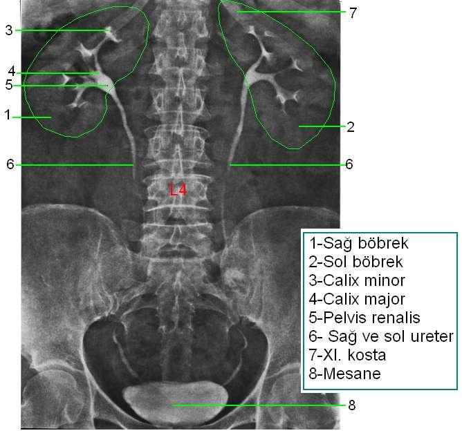 radyogram Resim 2.