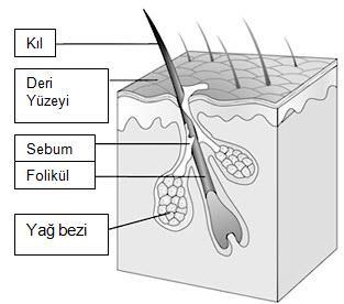 Mikroorganizmaların (Propionibakterium aknes) aşırı