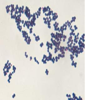 S.aureus lu olgularının %82 si, gram negatif mikroorganizmaların %91 i gram boyamada görülebilmektedir. Mikroorganizma görülmezse kültür sonucu beklenilmelidir.