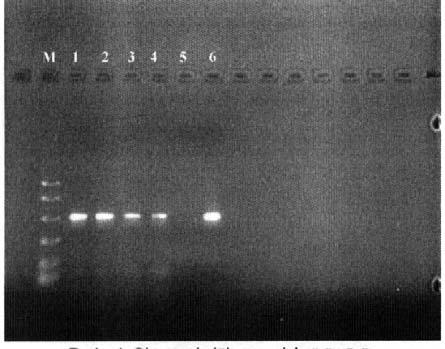 Türk Mikrobiyol Cem Derg 33: 66-70 MgCl2, 10 mm NaCl solüsyonuyla), sonra lökositlerin lizisi (10 mm Tris, 10 mm EDTA, 50 mm NaCl ve 200 μg Proteinaz K solüsyonuyla) yap lm flt r.