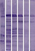 (A) 1 2 3 4 5 6 (B) 1 2 3 4 5 6 37.1 kda 37.1 kda 25.9 kda 19.4 kda 25.9 kda 19.4 kda Şekil 3.2. BALB/c fare ve iki gün aralıkla 4 ardışık HeLa hücre kültürü pasajından elde edilen antijenlerin A) SDS-PAGE ve B) Western blot yöntemi ile karşılaştırılması.