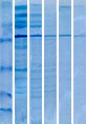 pasaj dan elde edilen antijen; 6. sütun: 4. pasaj dan elde edilen antijen. Western blot yöntemi sırasında BALB/c fare ve HeLa hücre kültürü 1. pasaj kaynaklı eşit miktarda T.