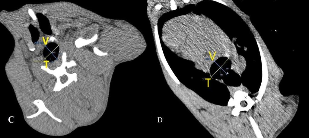 Trachea nın pars cervicalis inin 2D transversal kesitleri ; A: Cranial nokta; B: Caudal nokta; T: Transversal çap; V: Vertical çap. Şekil 3.