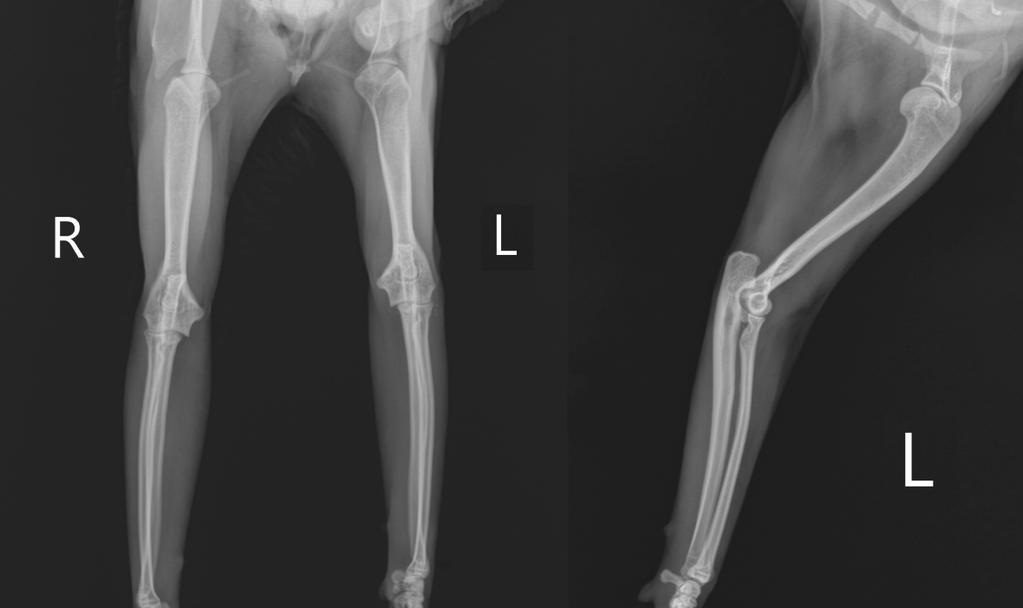 Şekil 2: Olgunun postoperatif mediolateral ve anterioposterior radyografileri.