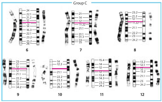 4. kromozom 1600 üzerinde gen Yaklaşık 190 milyon baz çifti Yaklaşık % 95 ı 5.