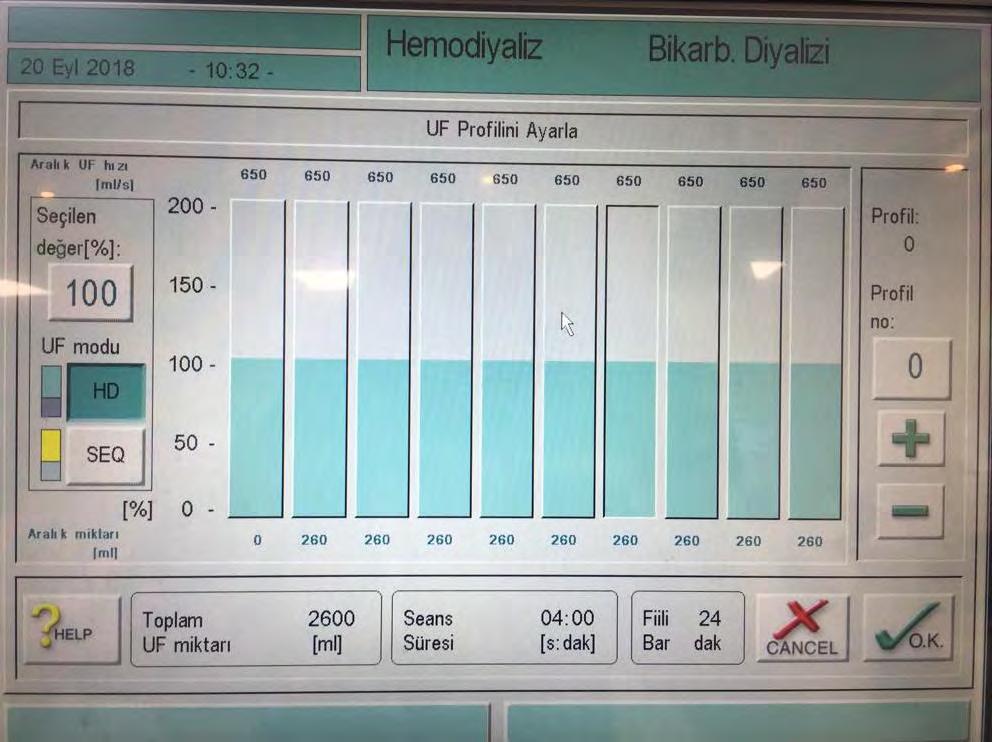 Açıklamalar 1-Profil numarası 2-Sonraki profil numarası 3-Önceki profil numarası 4-Diyalizat akışı olmadan