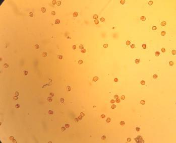 a b c Şekil 3.14. a. ve b. İzole edilen mikrosporların mikroskop altındaki görünüşleri, c. İzole edilmiş mikrospor tanesinin x100 objektifte ölçümü (22µm) 3.2.7.