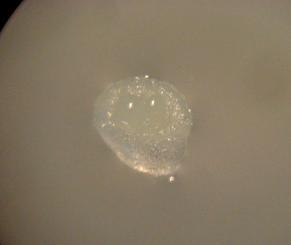 a b Şekil 3.18. Mikrosporlardan oluşan embriyoidler a. 20. gün sonunda mikroskop altında (x4) görülen globular embriyoid (bar: 0.