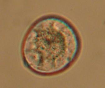 Mikrosporlar yıldız şekli nde görülmüş ve bu yapılar indüksiyon ortamında tekrarlanan simetrik bölünmeler sonucunda embriyoidleri meydana getirmiştir (Şekil 4.1.a, b). a b Şekil 4.1. Mikrosporların 7 gün 0.
