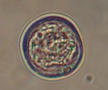 gün sonra embriyo benzeri yapılar ve embriyoidler gözlemlenmeye başlanmıştır (Şekil 4.3.). Ekmeklik buğday genotipi Gün-91 % 29.