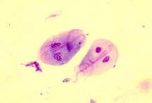 Giardia