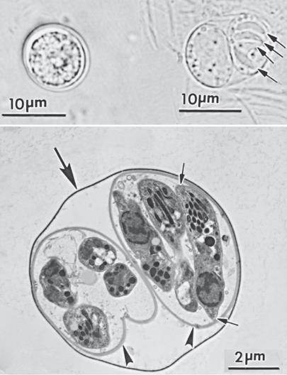 Etken. Toxoplasma gondii Sadece kedi türlerinde barsakta aseksüel ve seksüel üremelerini gerçekleştirebilirler.