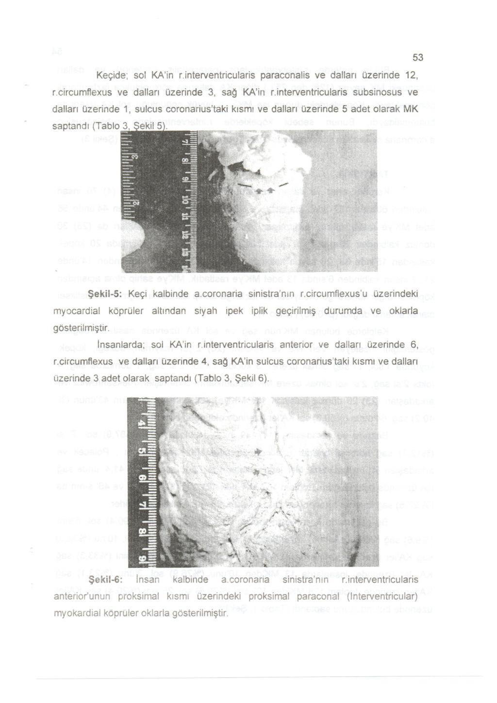 Kec;:ide;sol KA'in r.interventricularisparaconalisve dallan Ozerinde12, r.circumflexus ve dallan Ozerinde 3, saq KA'in r.