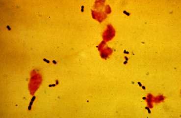 Streptococcus