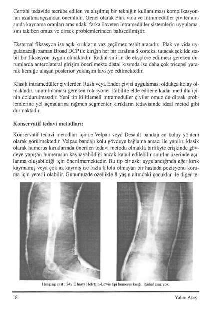 Cenahi tedavide tecrübe edilen ve alışılmış bir tekniğin kullanılması komplikasyonları azaltma açısından önemlidir.