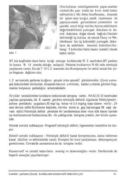 Şekil ı Oı1a kolonun osteoligamentöz yapısı anahtar roldedilbu yapı intakt ise kırık stabil kabul edilmelidir.( Mc Afee) Sınıflamalar, dinamik bir işlem olan kırığın,statik incelemesi ile yapılıyor.