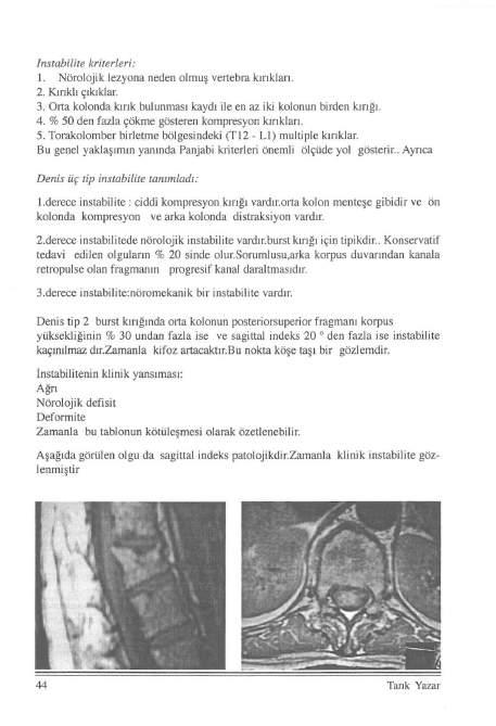 Instabilite kriterleri: i. Nörolojik lezyona neden olmuş venebra kırıkları. 2. Kırıklı çıluklar. 3. Orta kolonda lunk bulunması kaydı ile en az iki kolonun birden lurığı. 4.