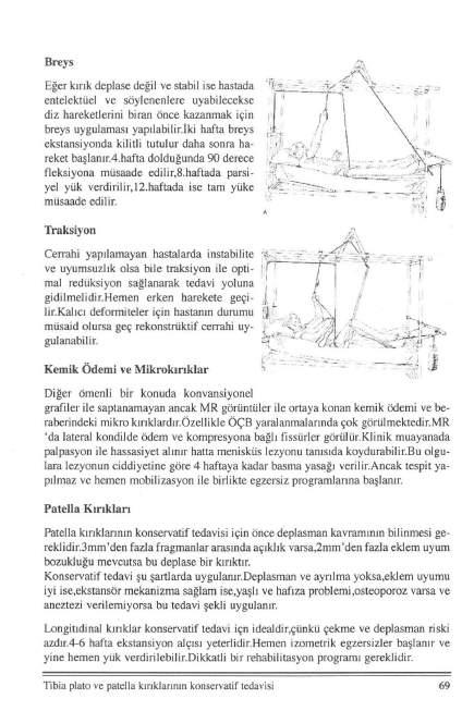 Breys Eğer kırık deplase değil ve stabil ise hastada entelektüel ve söylenenlere uyabilecekse diz hareketlerini biran önce kazanmak için breys uygulaması yapllabilir.