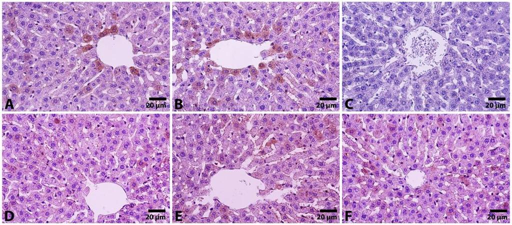 Q100+CYP grubu sıçanlara ait karaciğer kesitlerinde Bax immünpozitifliği.