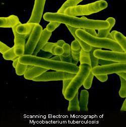 Etken mo: Mycobacterium tuberculosis Tüberküloz olgularının %97-%99 undan