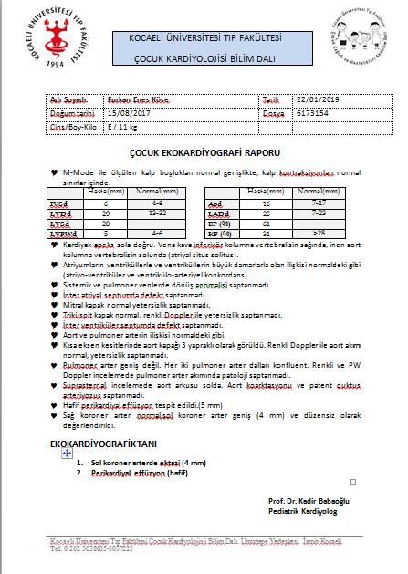 EKOKARDİYOGRAFİ Ekokardiyografik Tanı : - Sol koroner