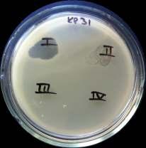 Bulgular 2 kolistin