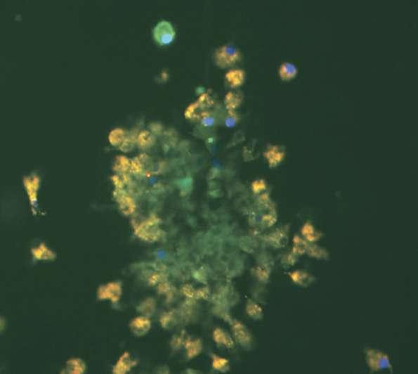 Şekil 12. Floresan mikroskopi ile koloni şekli oluşturmuş EPH lerin görüntülenmesi. (Roberts N. Ann Thorac Surg 2007;83:598 605 den alıntılanmıştır.