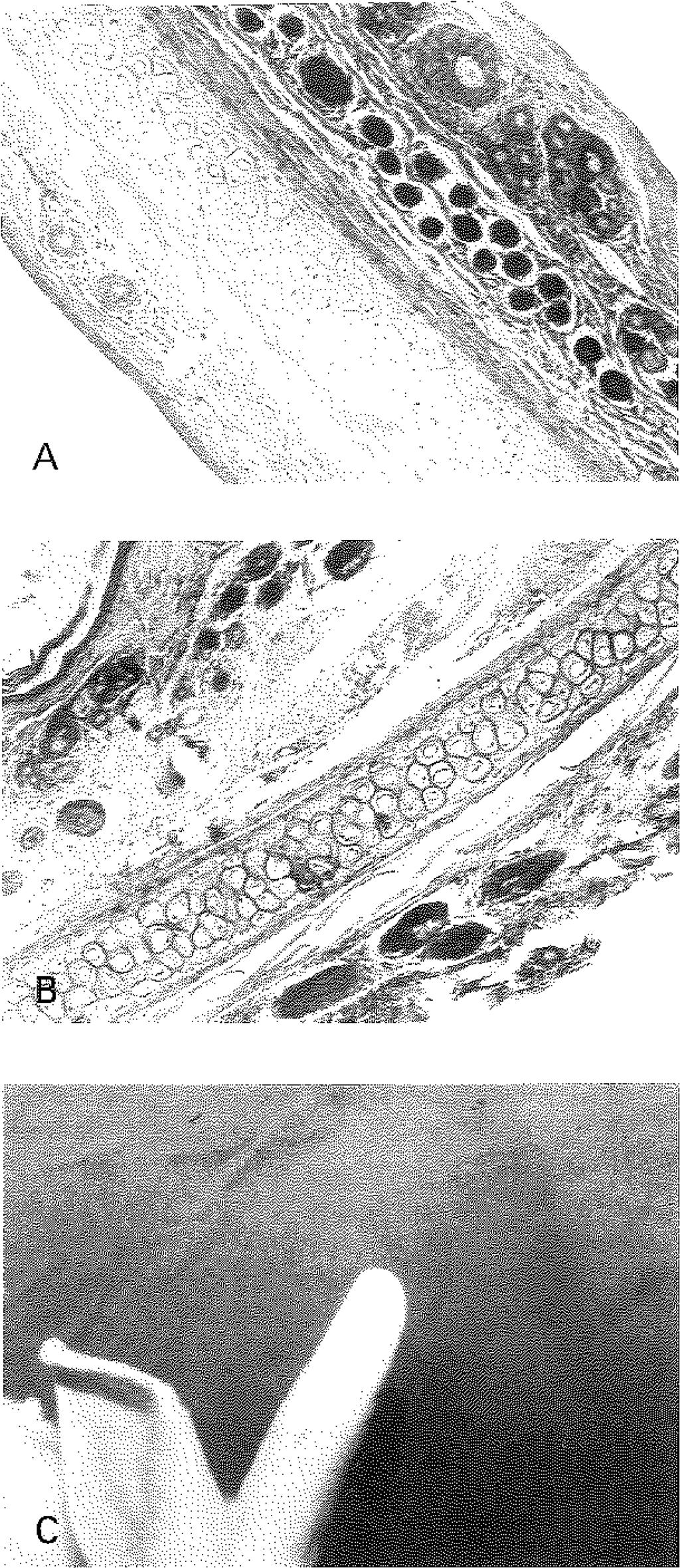 12 mm lik artış, hücre sayısında karşı kulağa göre 52 Şekil 3A: 1B grubu kıvrık kulak histolojik görünümü (H&ExlO) kartilajda, dış yüzey perikondriumda (sağda) kalınlaşma görülmektedir.