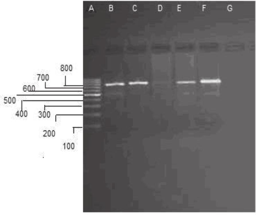 Türk Mikrobiyol Cem Derg 4():4-, 2 Tablo 4. Cag geni ile diğer virulans genlerinin karşılaştırılması. Sa/m Sa/m2 S2/m2 Ice A Ice A2 Bab A2 Cag A pozitif 42 6 4 anlamlı ilişki olduğu görülmüştür.