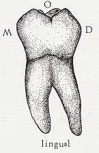 ġekil 1.3: Sağ alt I. molar lingual yüz ġekil 1.4: Sol alt I. molar lingual yüz 1.1.6. Mesial Yüz Servikalden oklüzale ve mesialden distale doğru daralan bir yamuk Ģeklindedir.