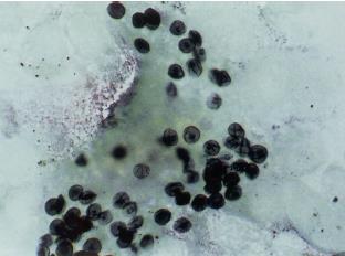 Mikroskopi ve boyama Kist duvarını boyayan yöntemler Grocott-Gomori-metenamin gümüş