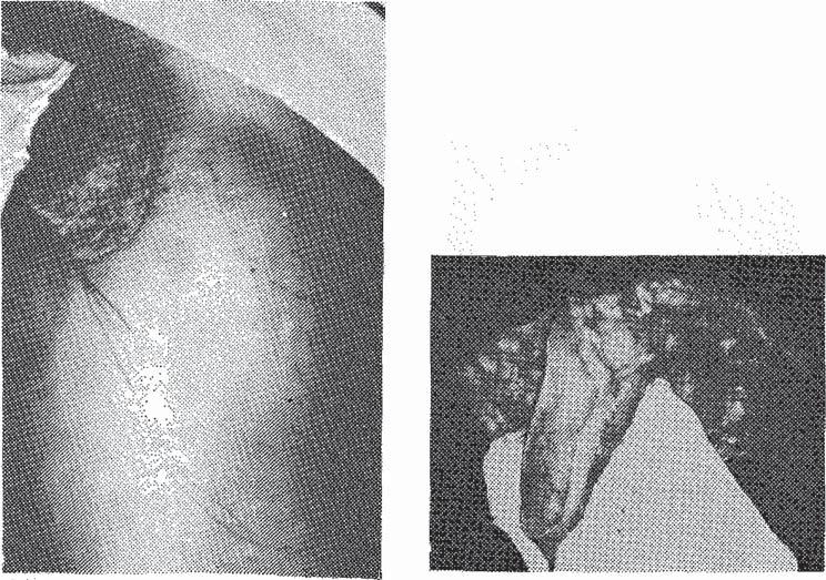 Superiyor kan damarları subskapular arterin dalı olan torakodorsal arterden gelir. Arter kasa, humerusa yapıştığı yerin 8-10 cm proksimalinden girer(6, 9).