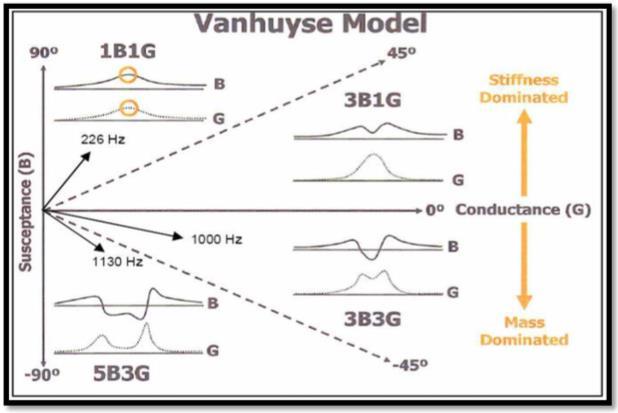 Şekil 13. Vanhuyse Modeli Paternleri (29). Susseptans eğrisinde çentik oluşumu incelendiğinde (3B nin oluşması); çentik alt noktasının eğrinin pozitif ucuyla ilişkisi önemlidir.