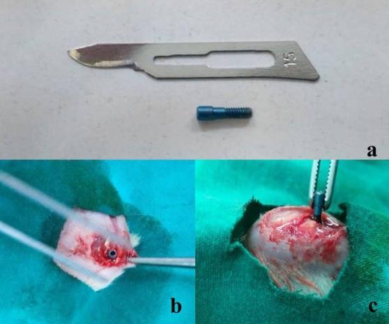 Analizler yapılırken yükün eksenel bir şekilde uygulanmasına özen gösterildi ve kemiğe dik yerleştirilememiş implantlar basma testinin standardizasyonu açısından çalışma dışı bırakıldı.