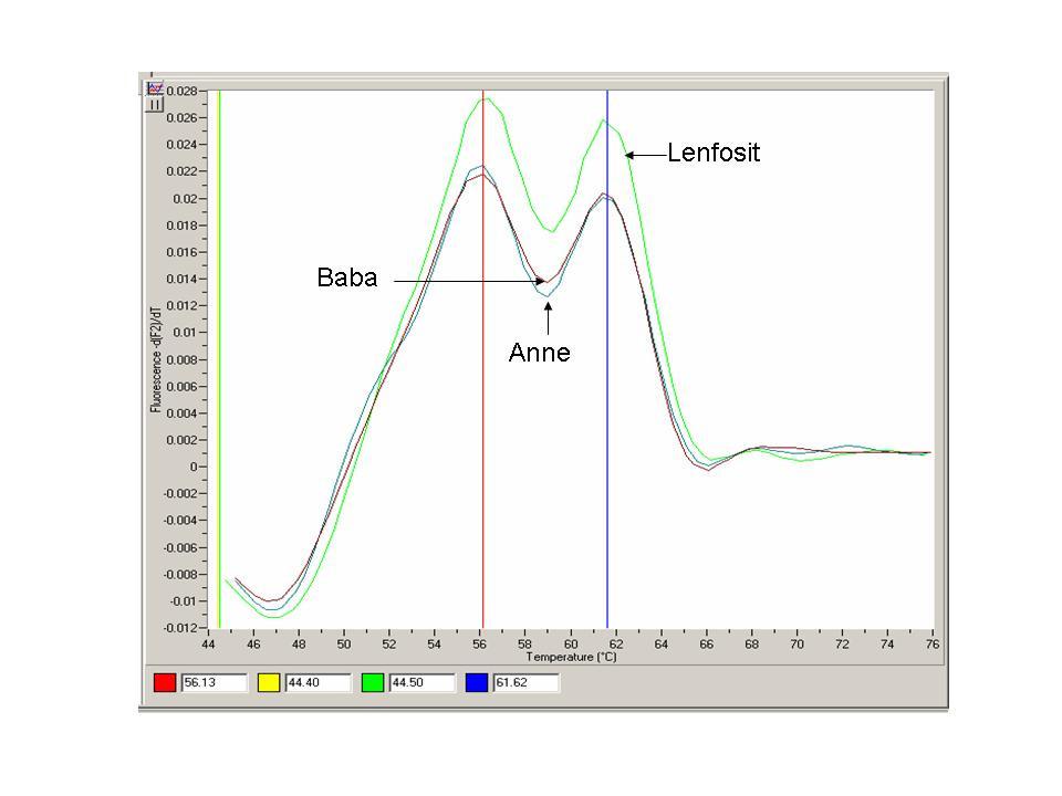 f) Olgu 6: IVSI-110 heterozigot mutasyon taşıdığı bilinen 11 yaşında kız olgu. Anne ve babası da aynı mutasyonu taşımaktaydı ve akrabalık belirtmediler.